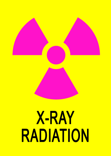 X-ray hazard graphic